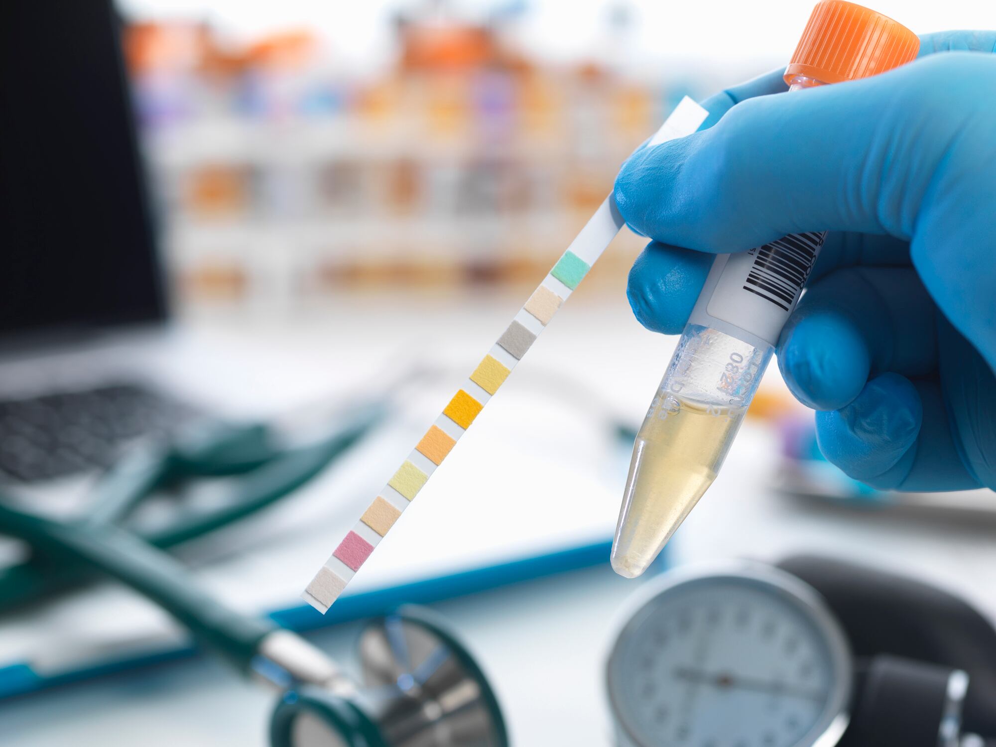 A photo showing a urine sample and test strip showing results.