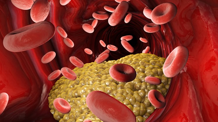 Cholesterol lowering aid? Swisse to run human clinical trial on practitioner-only formula