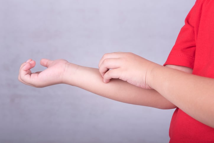 Probiotic and eczema: GenieBiome launching synbiotics clinically tested on young kids to Singapore market