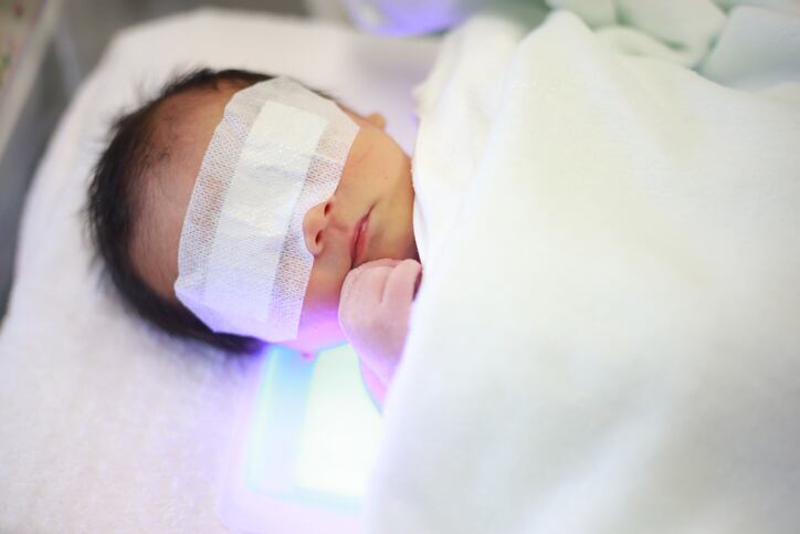 Probiotics with phototherapy may help manage neonatal jaundice, gut health: Taiwan study