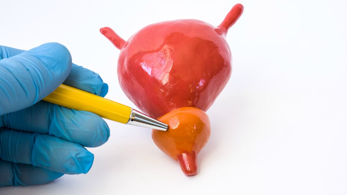 Prostate potential: Korean biotech firm develops botanical complex with prostate health benefits