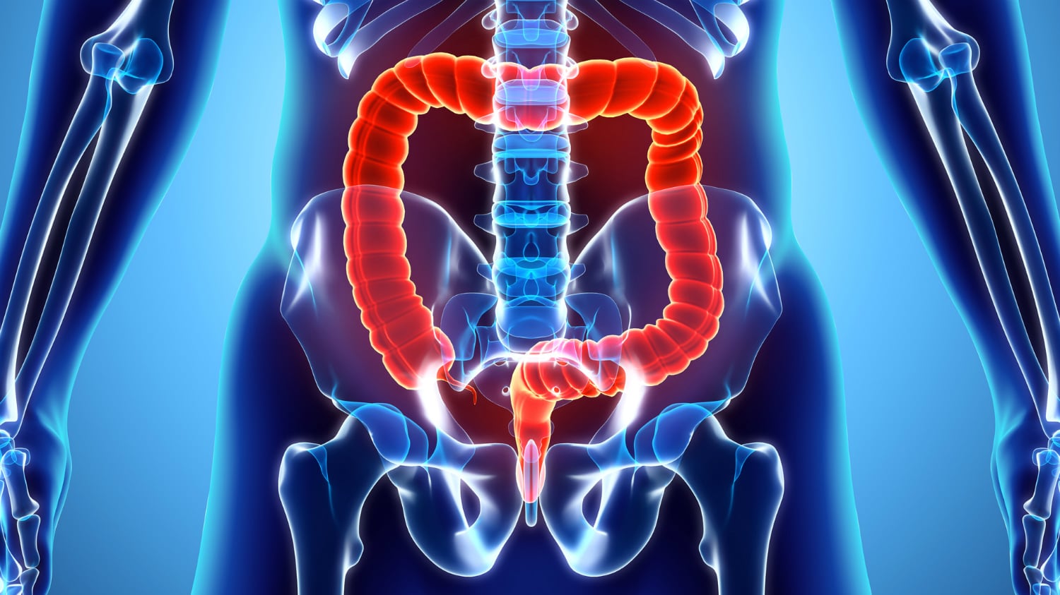Synbiotics against sepsis: Can treatment help prevent enteritis and pneumonia?
