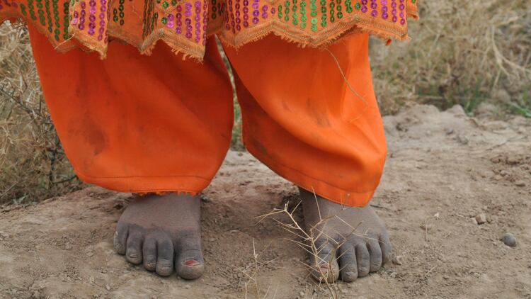 Grave concern: Severe malnutrition rising in Afghan kids and mums – Kabul researchers