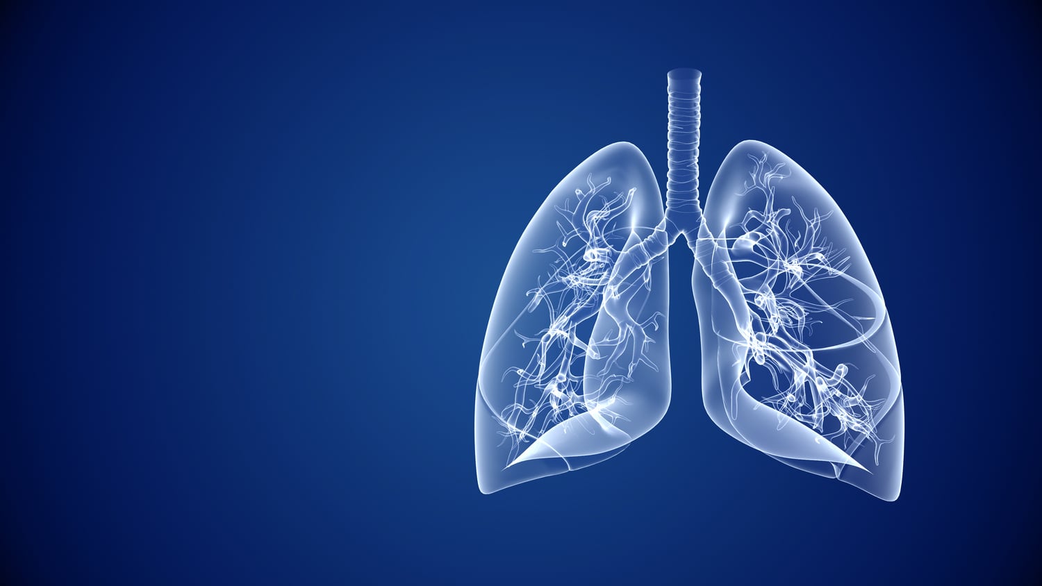 AstraZeneca-drug-with-chemo-shows-strong-improvement-for-lung-cancer-patients.jpg
