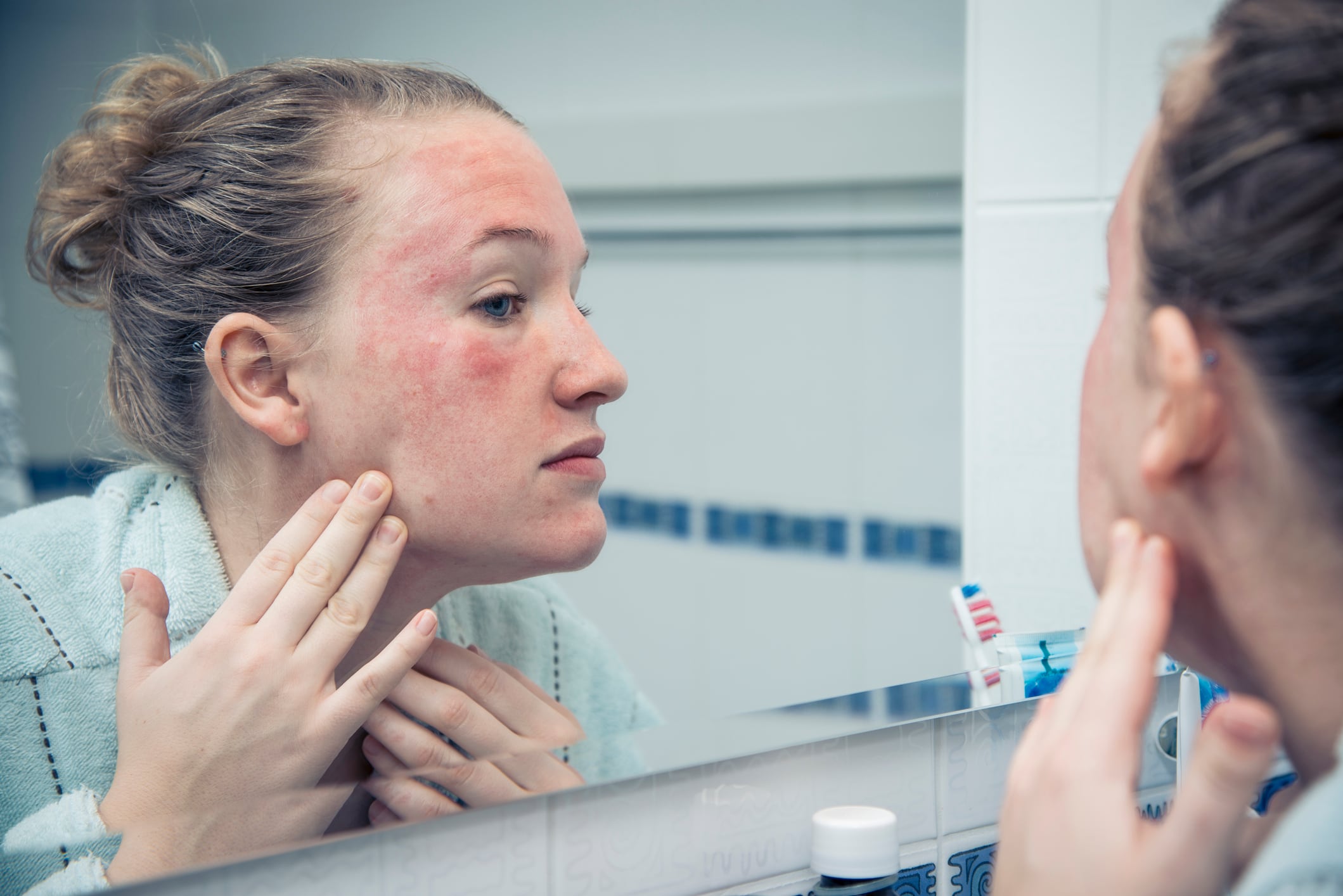 Chinese-research-hints-crucial-link-between-the-gut-microbiome-and-adult-dermatitis.jpg