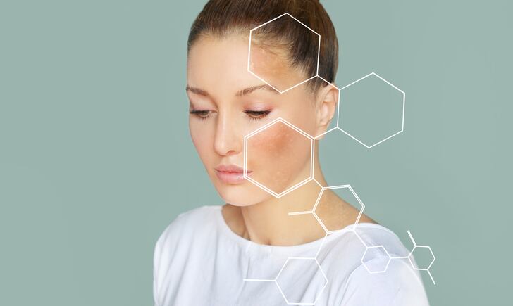 ‘Double approach’: Skin care brands launching oral supplements for anti-hyperpigmentation as awareness grows