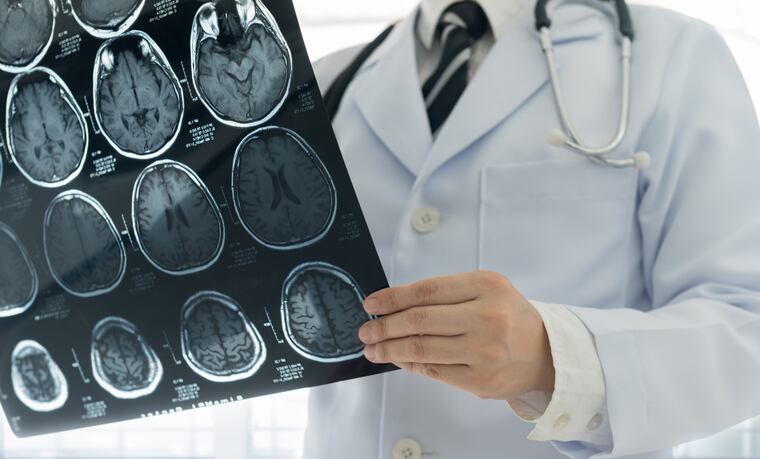 Astaxanthin supplement shows promise in brain health category: Two studies