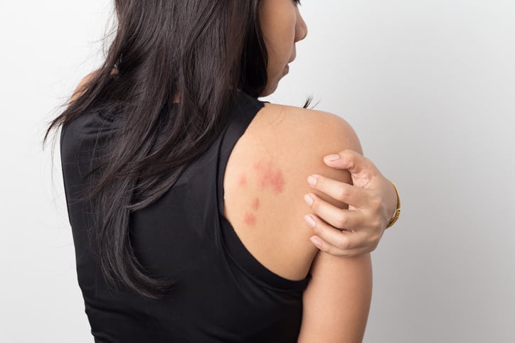 Supplements and skin health: Chinese college students with skin conditions more likely to take vits and minerals