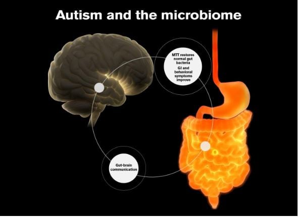 Researchers positive but cautious of 50% autism symptom reduction after faecal transplant