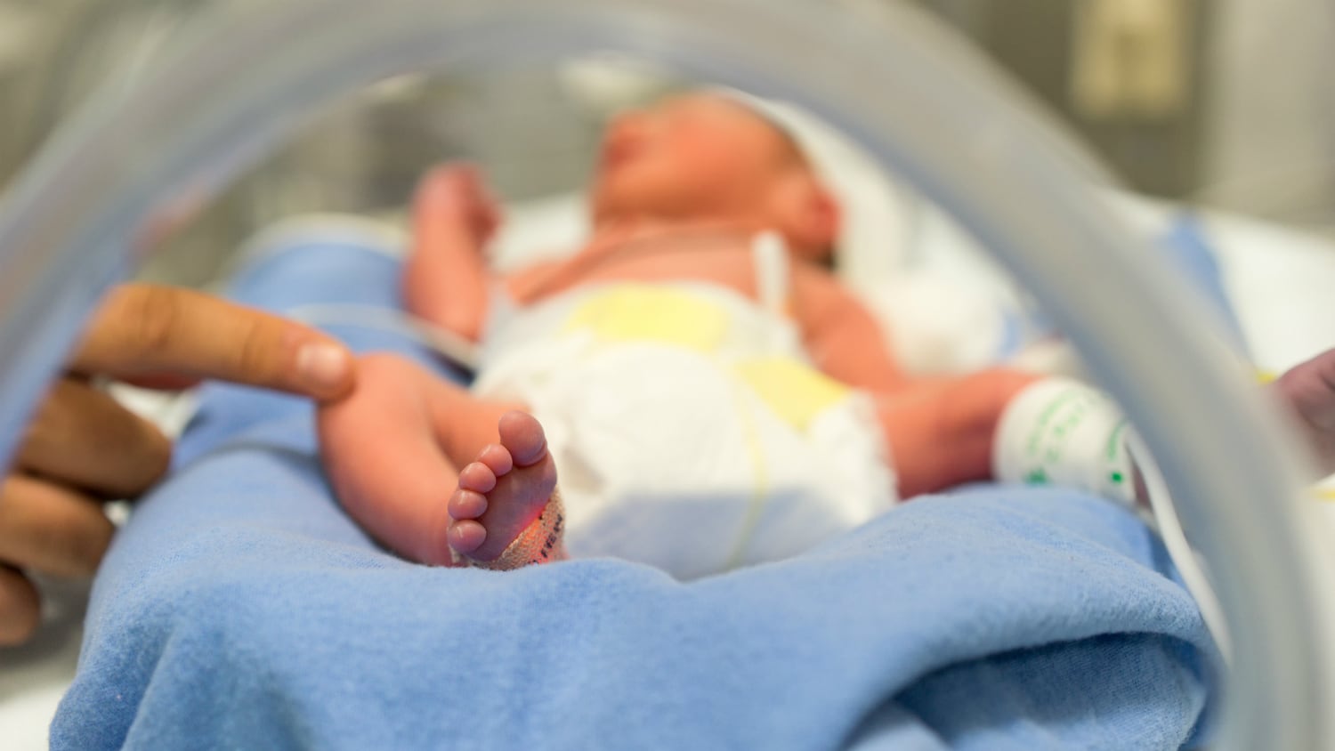 Probiotic supplementation may protect premature infants from NEC: Australian population study