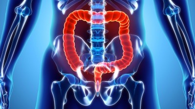 Researchers at Kobe University conducted a study to examine how various prebiotics would affect human colonic microbiota. ©Getty Images