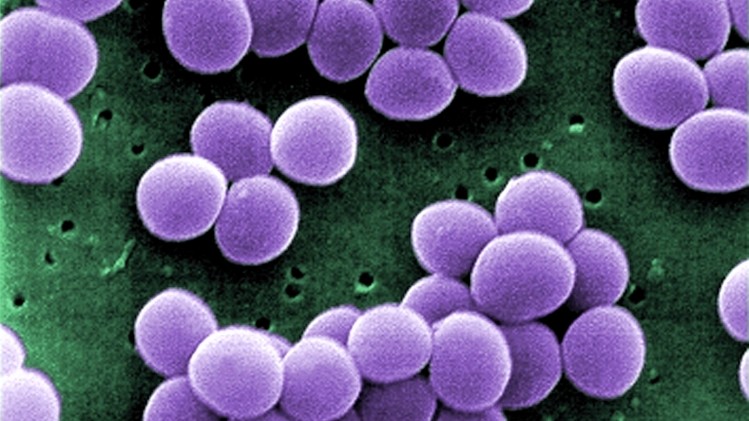 Staphylococcus aureus under the microscope