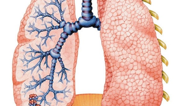 COPD is incurable and affects more than 1.45m Australians. ©iStock