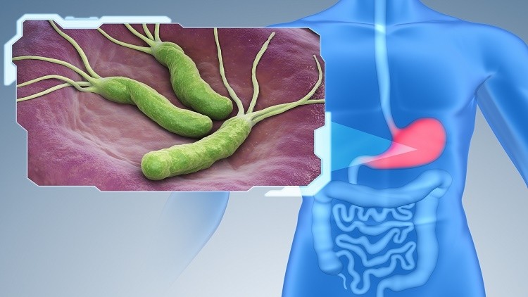 A 14-day probiotic and antibiotic therapy has shown to be effective in eradicting H. pylori amongst Thais with non-ulcer dyspepsia. ©Getty Images 