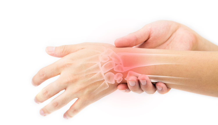 Researchers say that there is currently a lack of effective treatment for hand osteoarthritis. ©Getty Images 