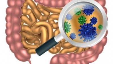 Engineered probiotic bacteria could be freely administered for their normal probiotic-associated benefits, while also potentially protecting against certain pathogens. ©iStock